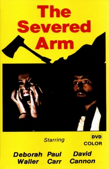 The Severed Arm - Große Hartbox von Inked Pictures - Limited Edition - Cover B